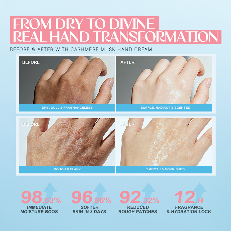 Yeast Hyaluronic Acid Deep Hydrating Hand Cream (5) Yeast Hyaluronic Acid Deep Hydrating Hand Cream (5)