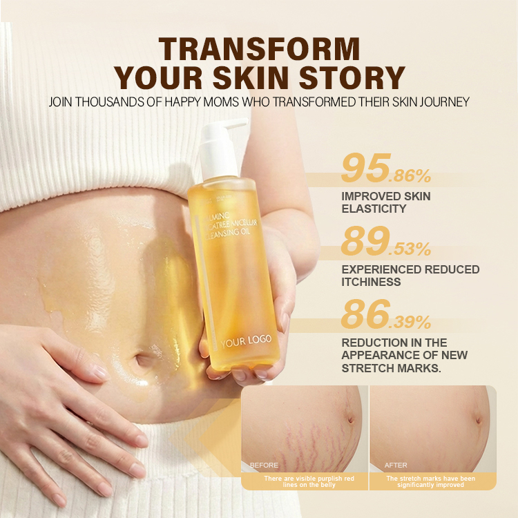Pregnancy Stretch Mark Prevention Oil (5) Pregnancy Stretch Mark Prevention Oil (5)