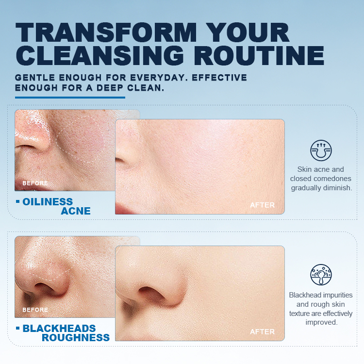 Korean Rice Mochi Face Cleanser (5) Korean Rice Mochi Face Cleanser (5)