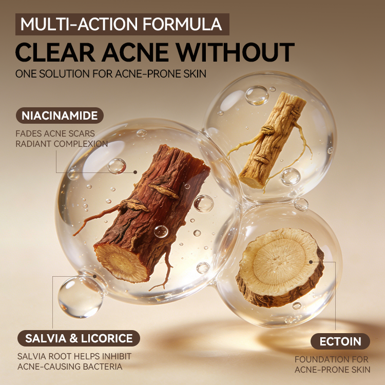 Acne-Clearing Essence Lotion (4) Acne-Clearing Essence Lotion (4)