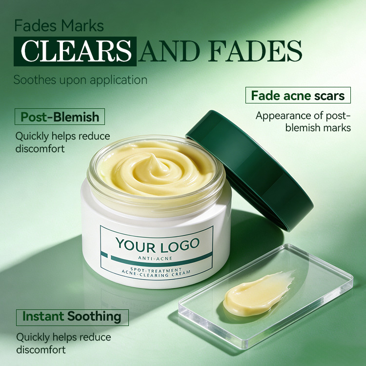 Spot-Treatment Acne-Clearing Cream (3) Spot-Treatment Acne-Clearing Cream (3)