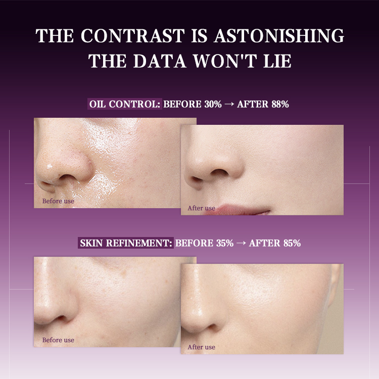 Perilla-Yeast Balancing Mask (5) Perilla-Yeast Balancing Mask (5)