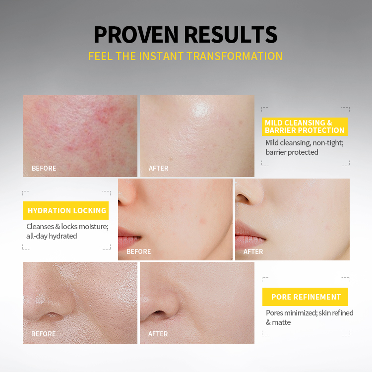 Amino Acid Face Cleanser5 Amino Acid Face Cleanser5