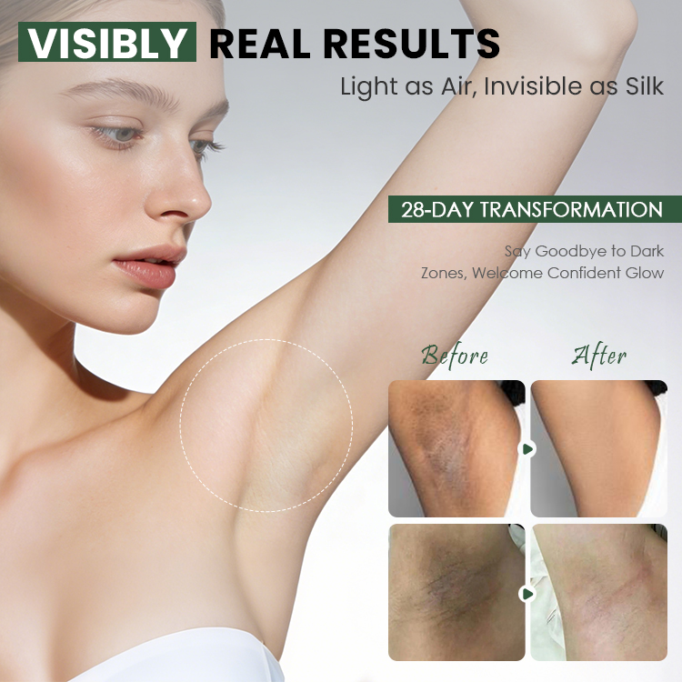 Underarm Brightening Whitening Lotion (5) Underarm Brightening Whitening Lotion (5)