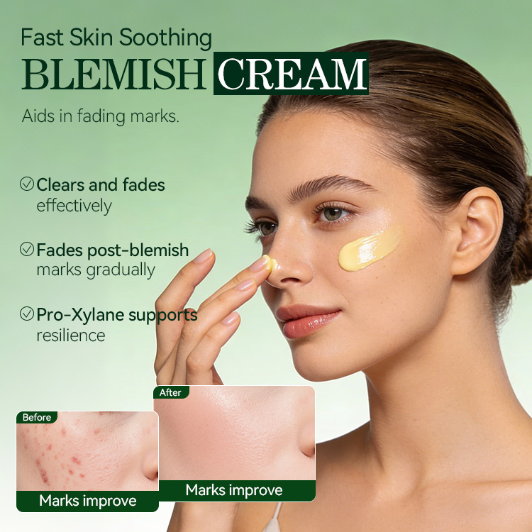 Spot-Treatment Acne-Clearing Cream (5) Spot-Treatment Acne-Clearing Cream (5)
