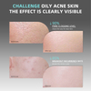 Glycolic Acid AHA Skin-Balancing Cotton Pads