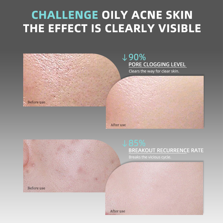 Glycolic Acid AHA Skin-Balancing Cotton Pads