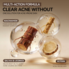 Acne-Clearing Essence Lotion