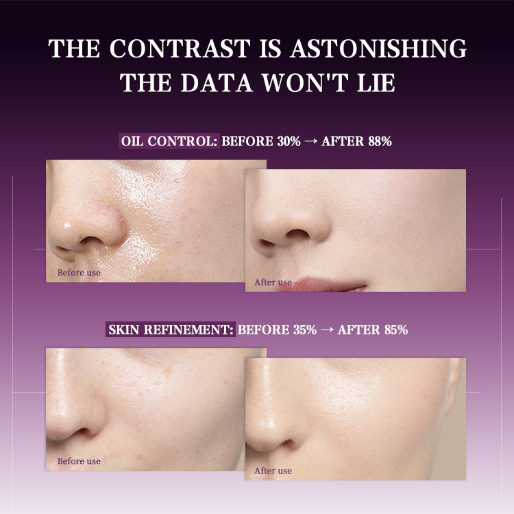 Perilla-Yeast Balancing Mask