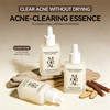 Acne-Clearing Essence Lotion