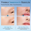 Pore-Minimizing Refining Serum