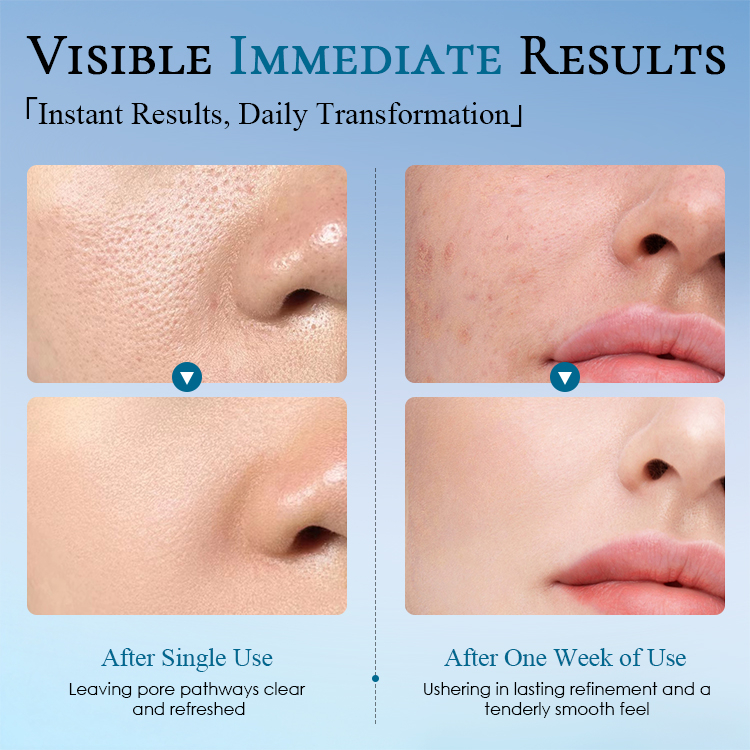 Pore-Minimizing Refining Serum