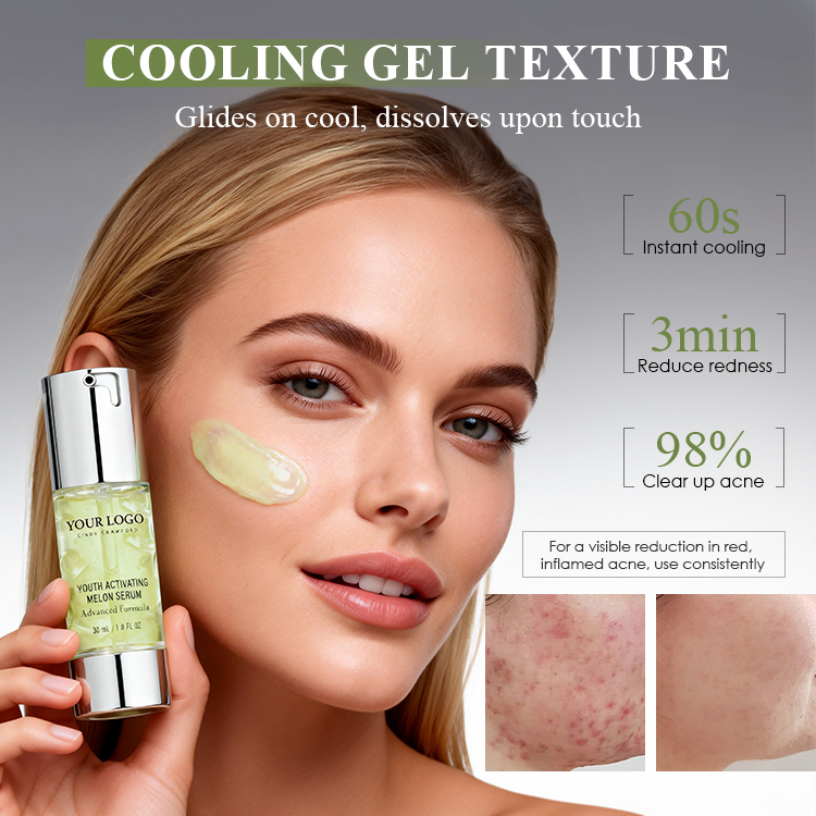 Acne-Treating Conditioning Gel